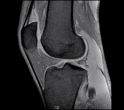 Магнитно-резонансная томография (МРТ) суставов и мягких тканей
